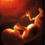 Definition of abortion - What it is, Meaning and Concept