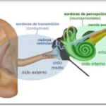 Definition of Hearing Loss - What it is, Meaning and Concept